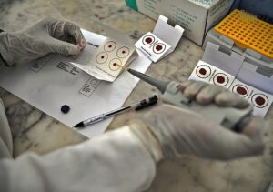 Новини України - На Сумщині від тропічної малярії помер чоловік