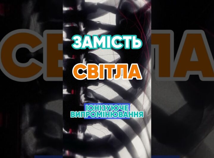 Чому рентген показує кістки? 🦴 #наука #цікаво #рентген #медицина